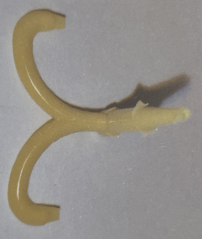 注塑産品缺陷料頭附近有暗區的理解